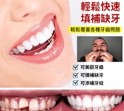 吸附性微笑牙套