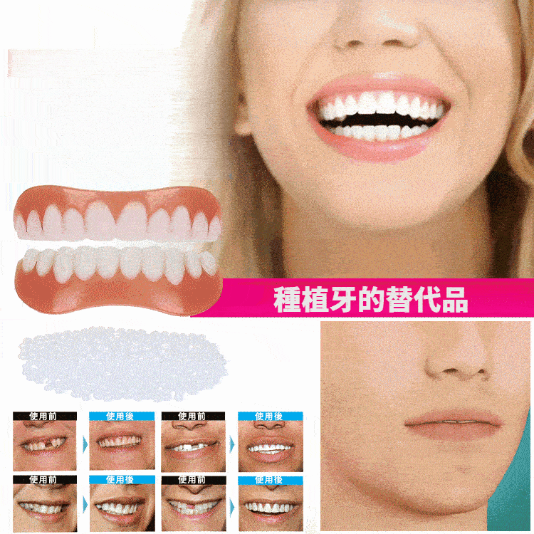 完美微笑假牙